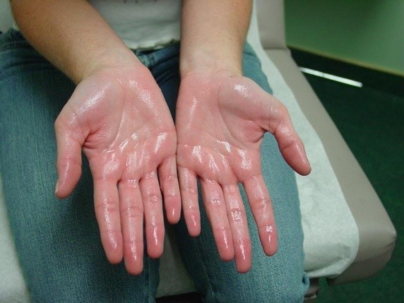 Wet hands to remove pet fur